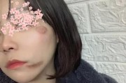 推脸器放了电池会有什么后果？（电池在推脸器中的潜在危害及其应对方法）